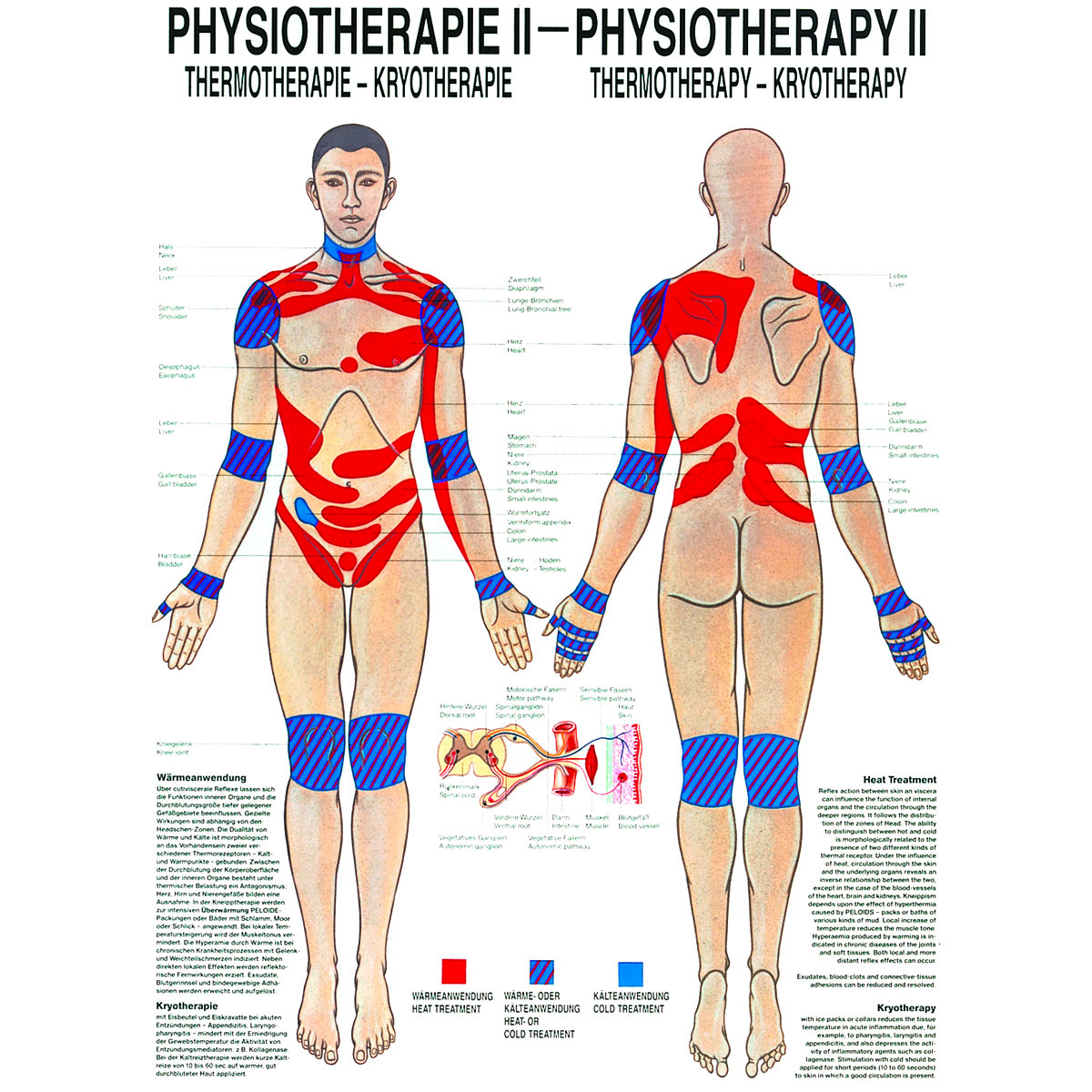 Anatomische Lehrtafel "Thermotherapie 34 x 24"